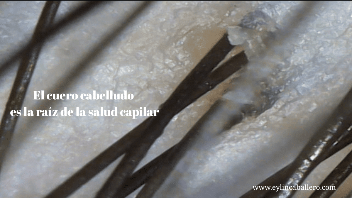 cuero cabelludo danado